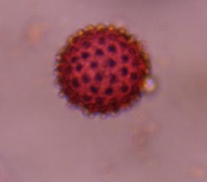 Chenopod pollen under a microscope, verified by PollyMap