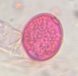 Celtis pollen under a microscope, verified by PollyMap