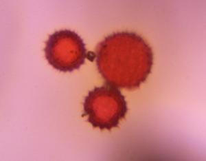 Asteraceae pollen under a microscope, verified by PollyMap