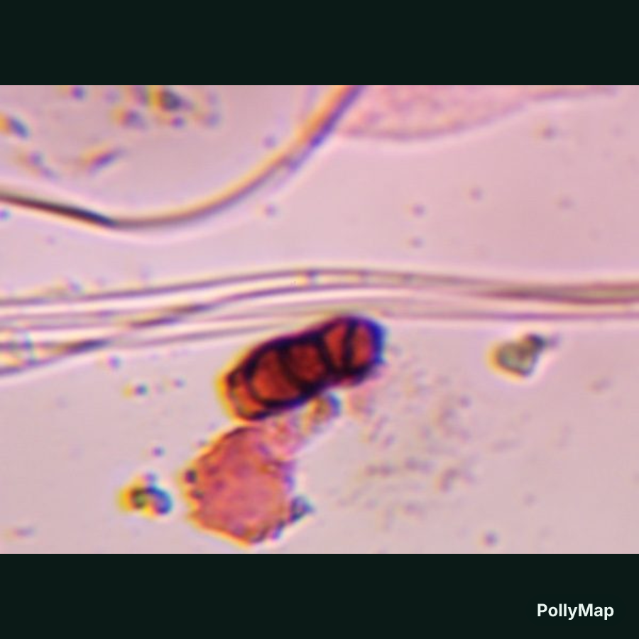 Another microscope image of Bipolaris/Drechslera, verified by PollyMap