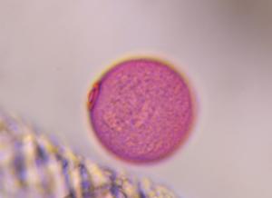 Poaceae pollen under a microscope, verified by PollyMap