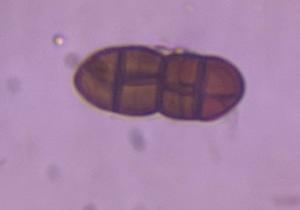 Pithomyces mold spore under a microscope, verified by PollyMap