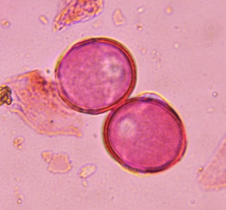 Another microscope image of Artemisia, verified by PollyMap