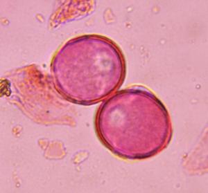 Artemisia pollen under a microscope, verified by PollyMap