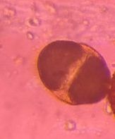 Another microscope image of Pine, verified by PollyMap