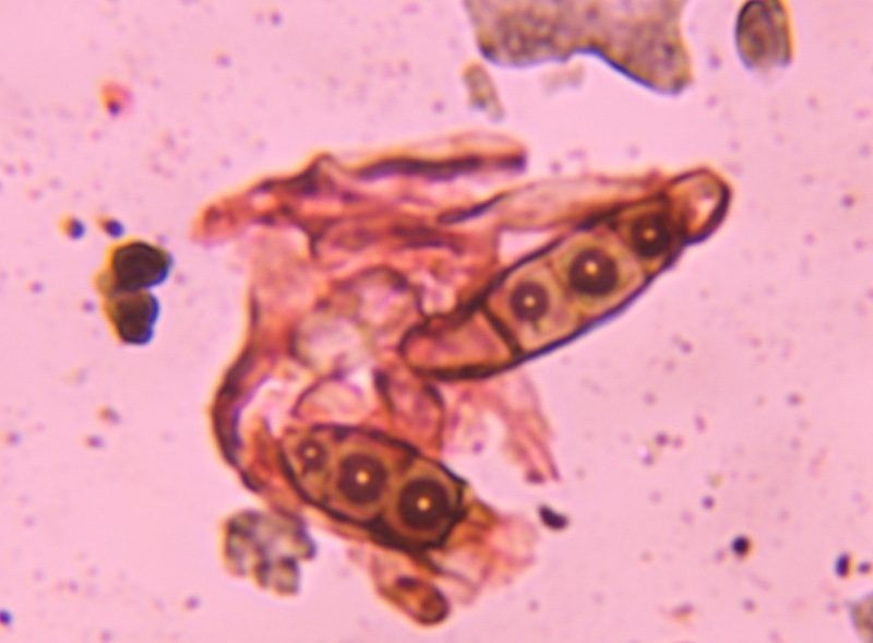 Microscope image of Bipolaris/Drechslera-type, verified by PollyMap