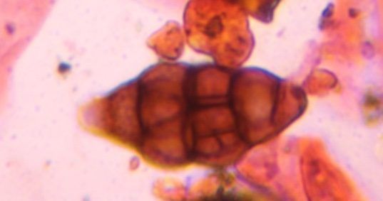 Another microscope image of Pleospora, verified by PollyMap