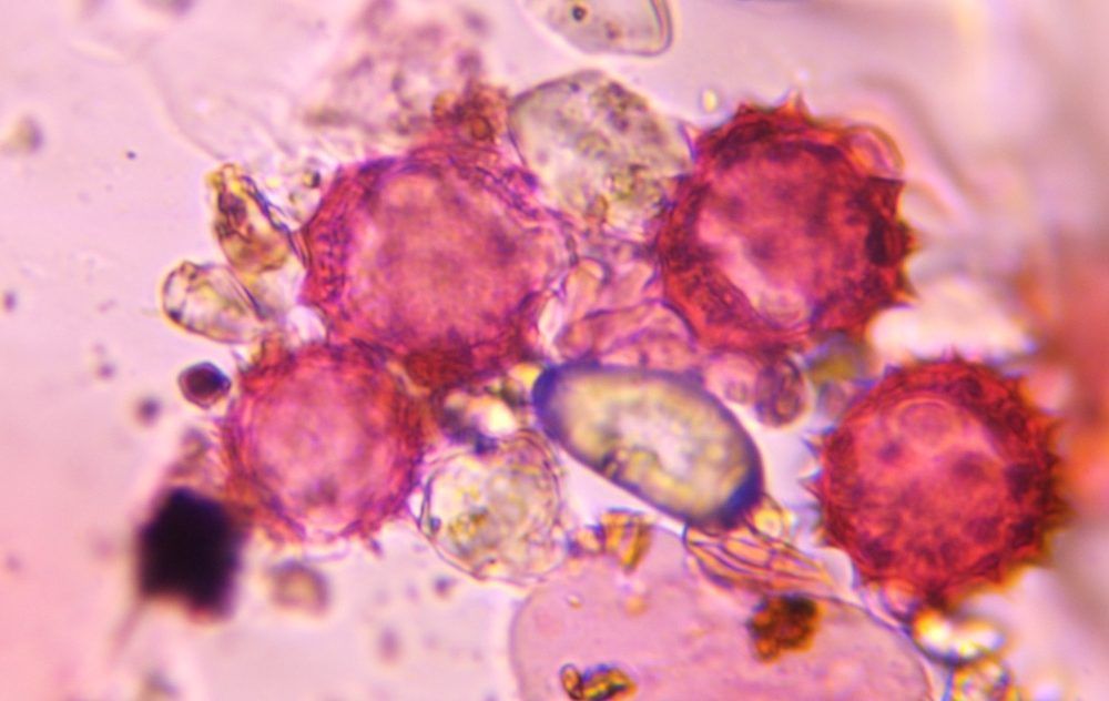 Asteraceae pollen under a microscope, verified by PollyMap