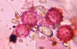 Asteraceae pollen under a microscope, verified by PollyMap