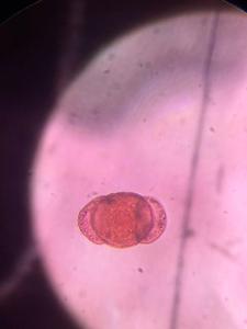 Pine (Pinus spp.) pollen under a microscope, verified by PollyMap