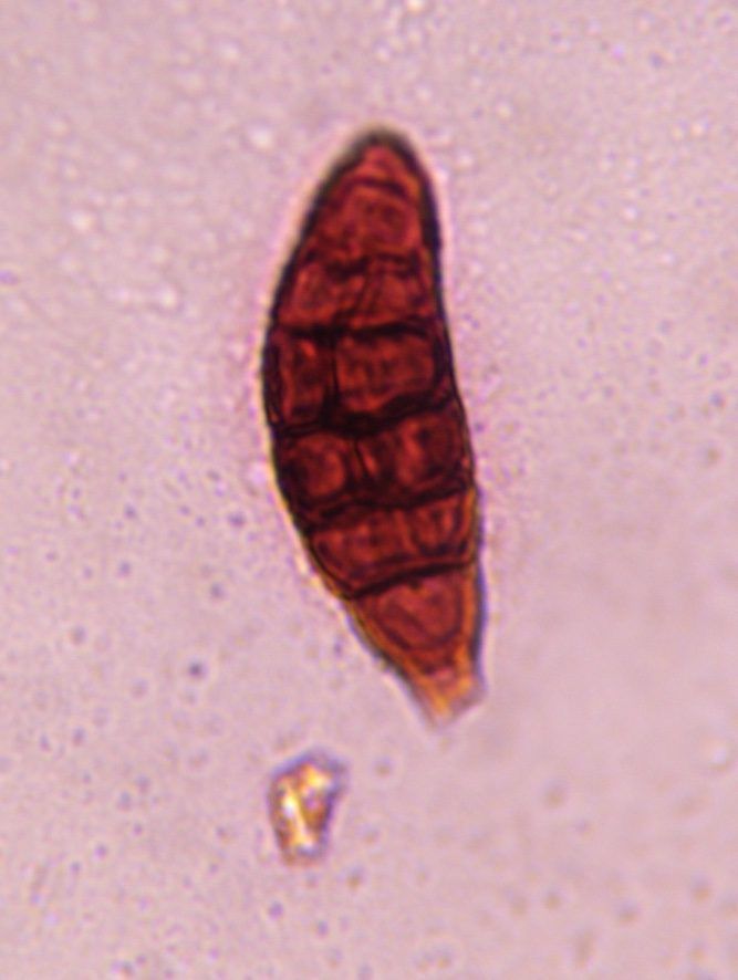 Alternaria mold spore under a microscope, verified by PollyMap