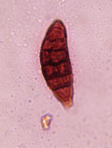 Alternaria mold spore under a microscope, verified by PollyMap