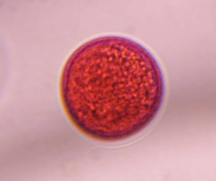 Another microscope image of Poaceae, verified by PollyMap