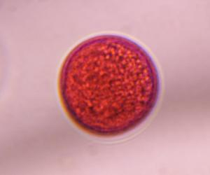 Poaceae pollen under a microscope, verified by PollyMap