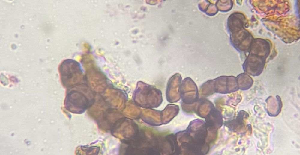 unidentified fungus mold spore under a microscope, verified by PollyMap