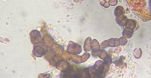 unidentified fungus mold spore under a microscope, verified by PollyMap