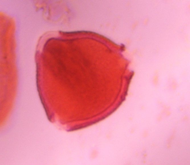 Unknown pollen under a microscope, verified by PollyMap