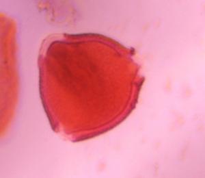 Unknown pollen under a microscope, verified by PollyMap
