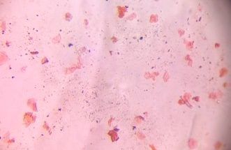 Microscope image of Squamous epithelial cells (Skin flakes), verified by PollyMap