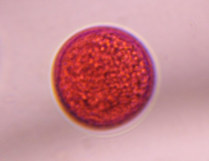 Another microscope image of Poaceae, verified by PollyMap