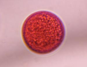 Poaceae pollen under a microscope, verified by PollyMap