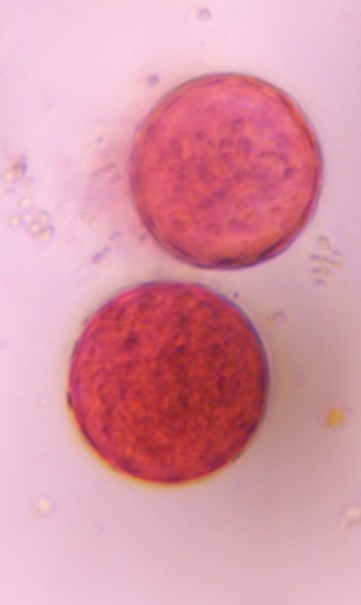Chenopod pollen under a microscope, verified by PollyMap