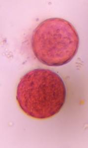 Chenopod pollen under a microscope, verified by PollyMap