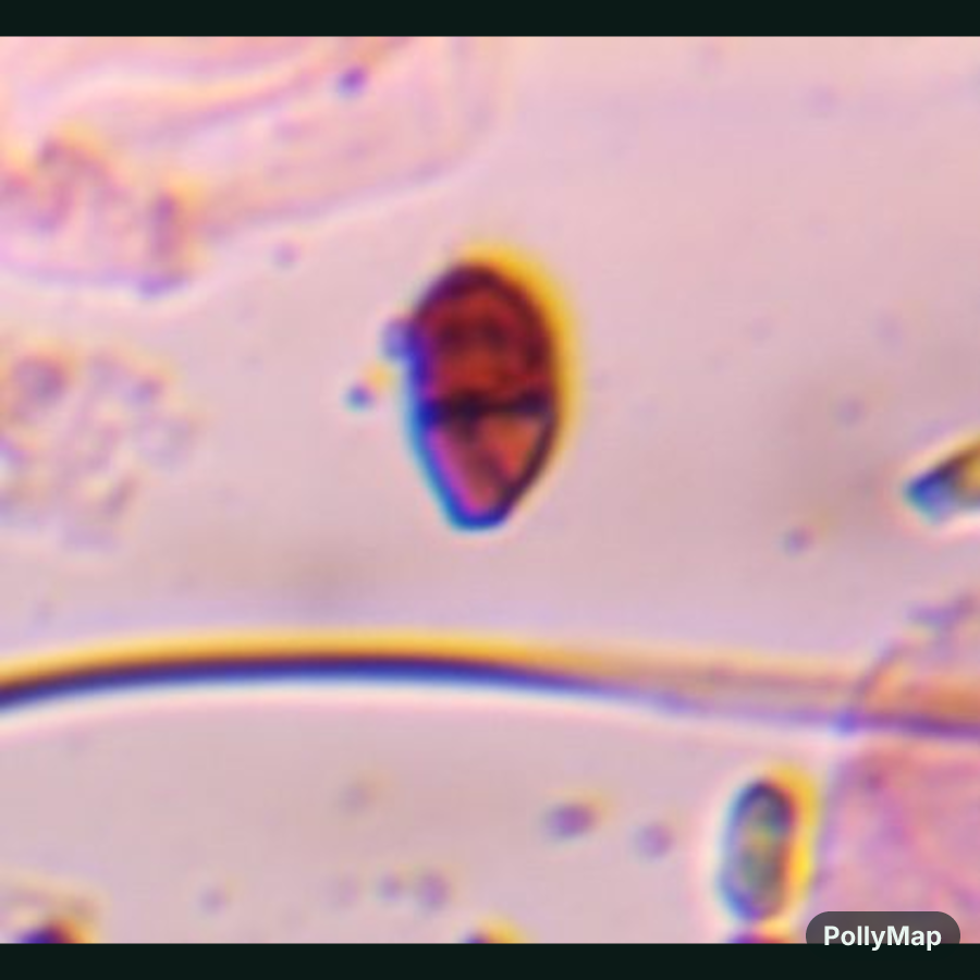 Microscope image of Rust teliospore, verified by PollyMap