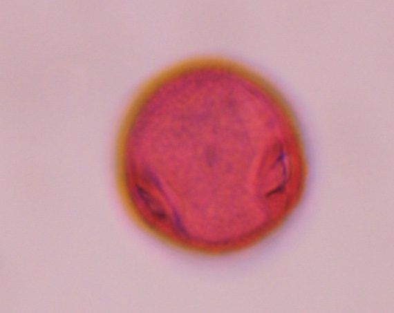 Artemisia pollen under a microscope, verified by PollyMap