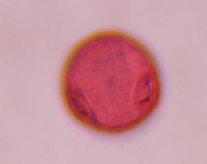 Artemisia pollen under a microscope, verified by PollyMap