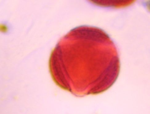 Artemisia pollen under a microscope, verified by PollyMap
