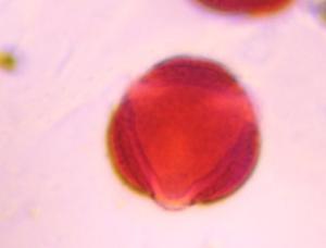 Artemisia pollen under a microscope, verified by PollyMap