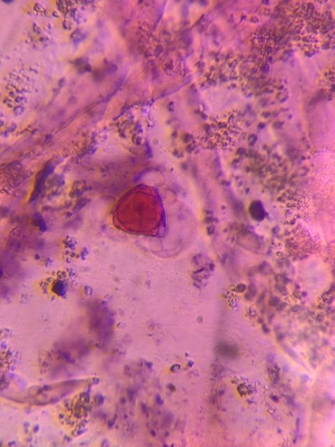 Eucalyptus pollen under a microscope, verified by PollyMap