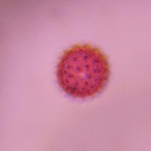 Asteraceae pollen under a microscope, verified by PollyMap
