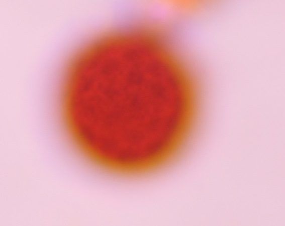 Chenopod pollen under a microscope, verified by PollyMap