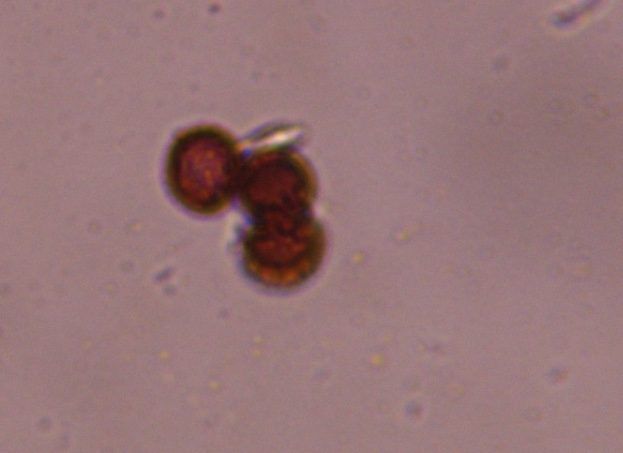 Smut mold spore under a microscope, verified by PollyMap