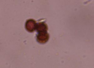 Smut mold spore under a microscope, verified by PollyMap
