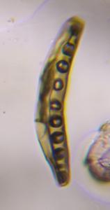 Bipolaris/Drechslera-type mold spore under a microscope, verified by PollyMap