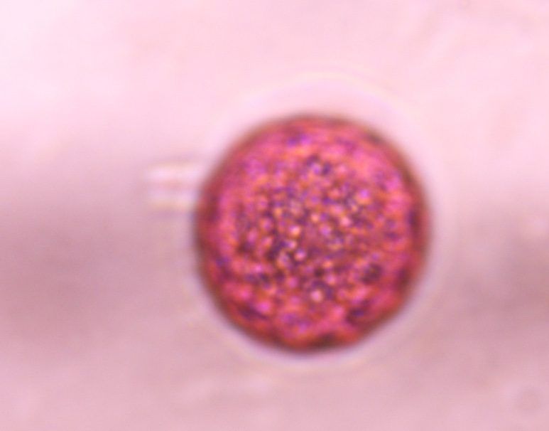 Another microscope image of Chenopod, verified by PollyMap