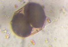 Another microscope image of Pine, verified by PollyMap