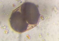 Pine pollen under a microscope, verified by PollyMap