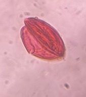 unidentified pollen under a microscope, verified by PollyMap