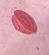 unidentified pollen under a microscope, verified by PollyMap