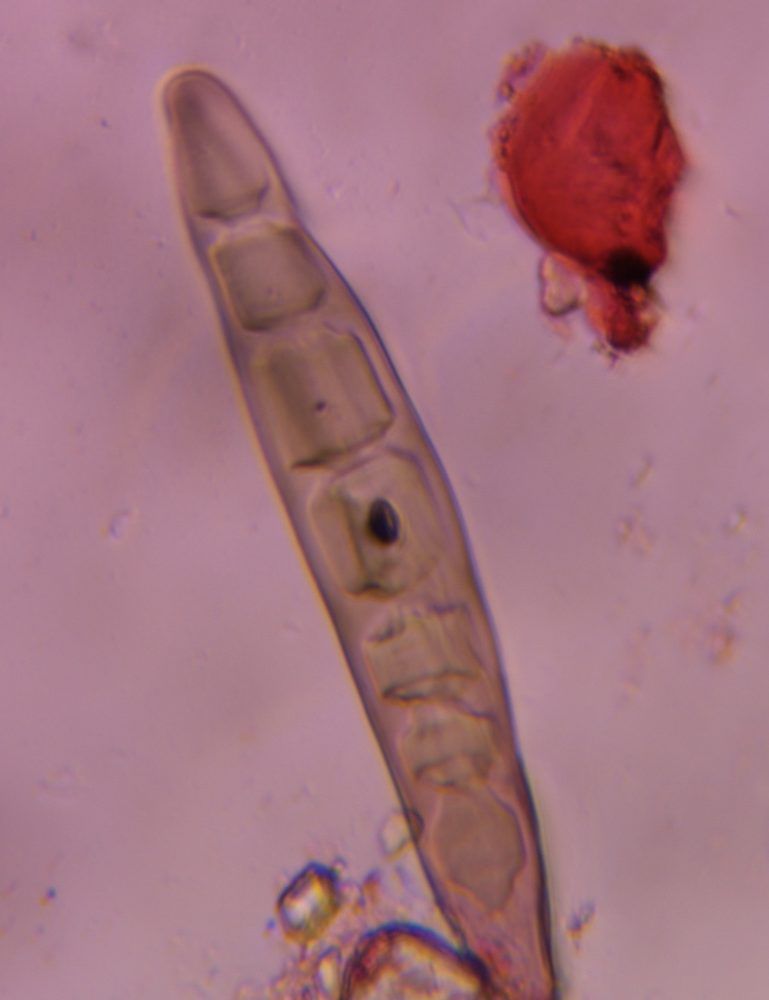 Bipolaris/Drechslera-type mold spore under a microscope, verified by PollyMap