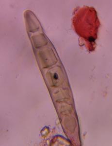 Bipolaris/Drechslera-type mold spore under a microscope, verified by PollyMap