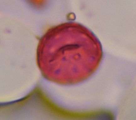 Chenopod pollen under a microscope, verified by PollyMap
