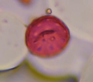 Chenopod pollen under a microscope, verified by PollyMap