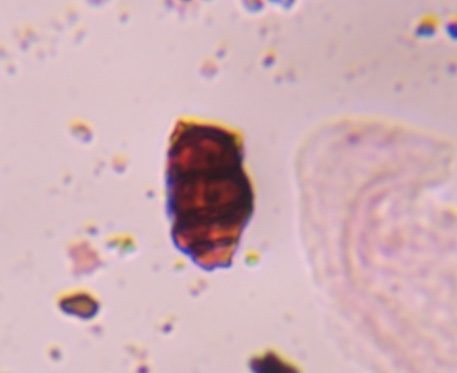 Pithomyces mold spore under a microscope, verified by PollyMap