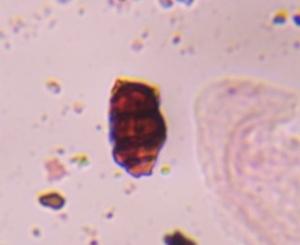 Pithomyces mold spore under a microscope, verified by PollyMap