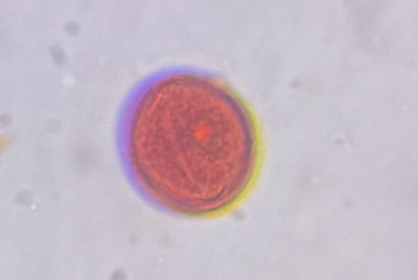 Mesquite pollen under a microscope, verified by PollyMap